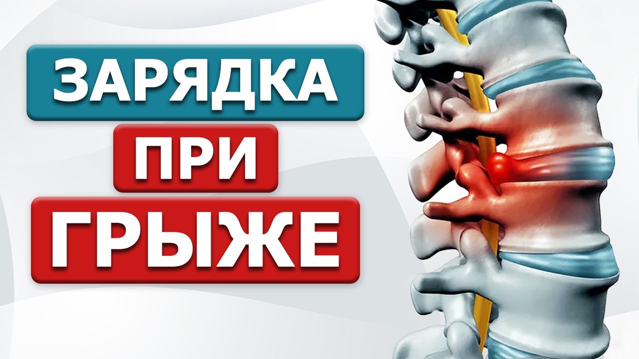 5 практик уберут грыжу поясничного отдела! ЛФК при экструзии и протрузии