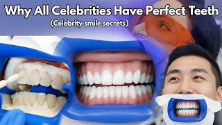 Why All Celebrities Have Perfect Teeth Celebrity Smile Secrets Revealed