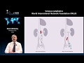 Pelvic congestion syndrome explained by Prof Mark Whiteley