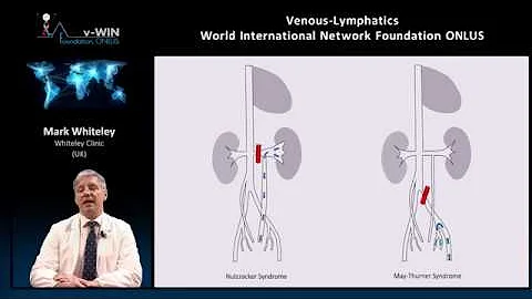 Pelvic congestion syndrome explained by Prof Mark Whiteley - DayDayNews