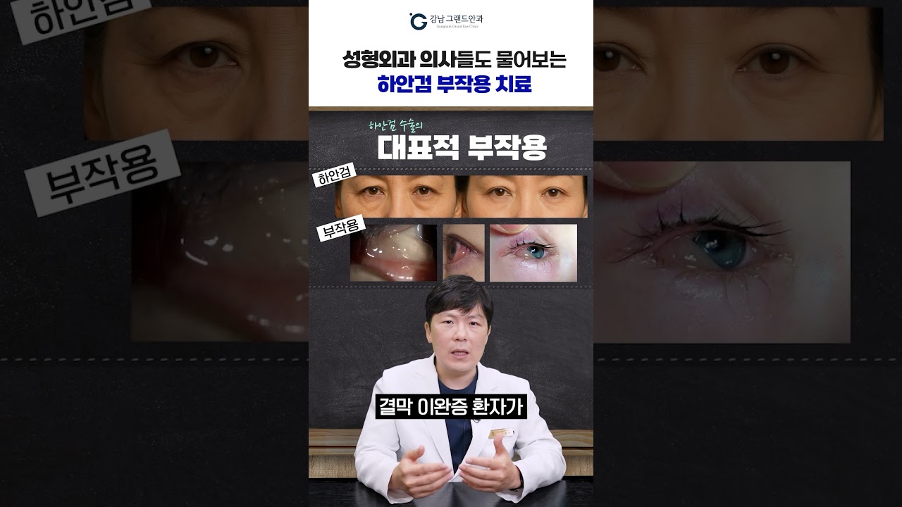 [Ганнам Гранд Нүдний Эмнэлэг] #shorts #доод_зовхины_гаж_нөлөө Энэ лазераар төгс шийдвэрлээрэй #Гоо_сайхны_мэс_заслын_эмч_нар_ч_асуудаг #Акютрон