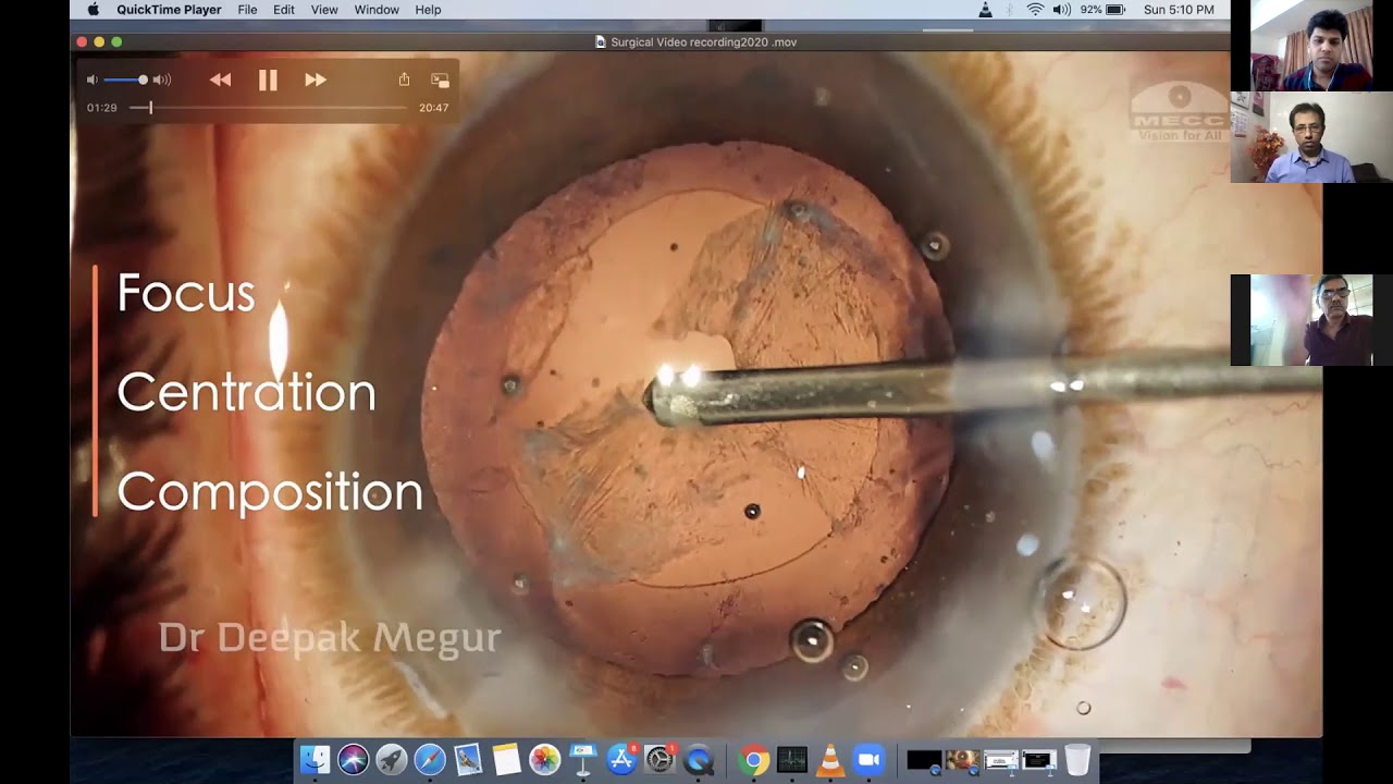 BOA surgical recording YouTube