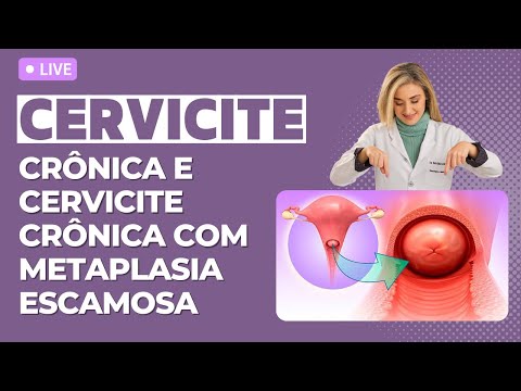 Vídeo: Como evitar o vício em álcool (com fotos)