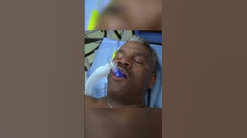 Chaos in the Operating Room: Mr. Bean