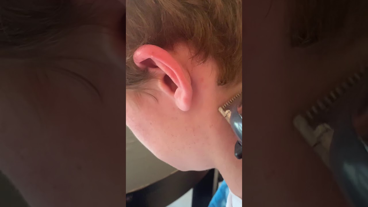 Quarantine hairline cleanup tutorial