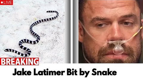 Survivor 49’s Jake Latimer Details Recovery After Being Bit by Snake | Health Update