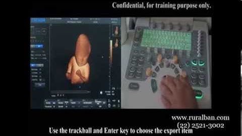 Chison Q5 - Eco - Doppler Color Digital