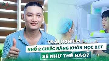 Cảm Giác Của Bạn Khi Nhổ 2 Chiếc Răng Khôn Cùng Lúc Sẽ Như Thế Nào.