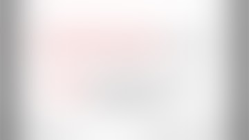 Bypass - Minimally Invasive Surgery in Giant Thrombosed MCA Aneurysms