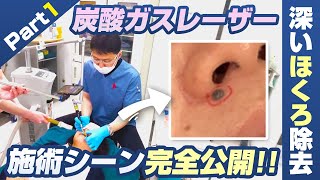 ほくろ mqdefault.jpg