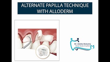 ALTERNATE PAPILLA TECHNIQUE with ALLODERM| SUBMERGED GRAFTS| ROOT COVERAGE TECHNIQUE| DR. ANKITA