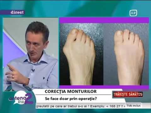 Video: Cum Se Găsește Proiecția Piciorului Către Hipotenuză