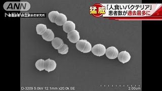 「人食いバクテリア」患者数が過去最多の442人に(16/11/25)
