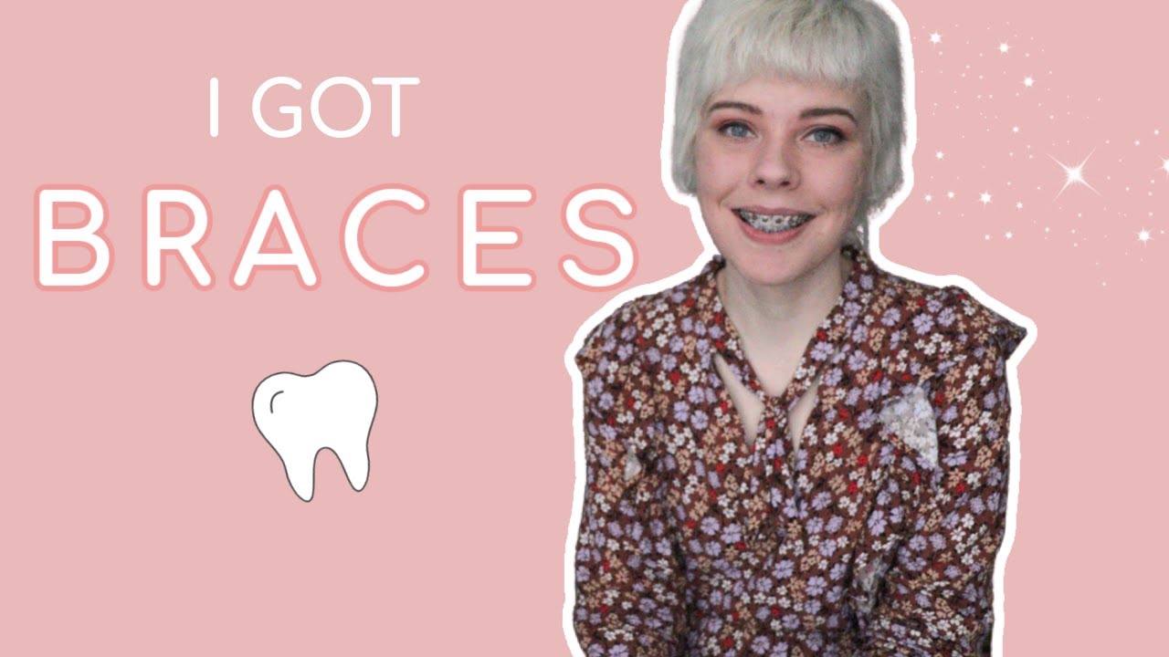 Adult Braces Consultation, Price And My Experience Getting Braces