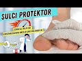 Sulci Protektor | Schnelle Hilfe bei EINGEWACHSENEN NÄGELN &amp; ROLLNÄGELN