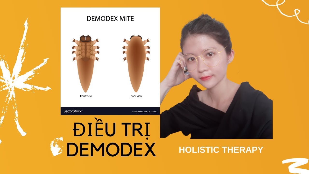 DA MẶT BỊ ĐỎ, DỊ ỨNG, BỆNH ROSACEA, GIÃN MAO MẠCH : DEMODEX | MOONSTORY | Khái quát các nội dung liên quan demodex la gi chi tiết nhất