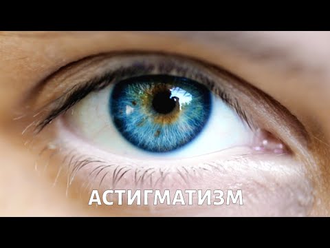 Астигматизм. PROЗРЕНИЕ