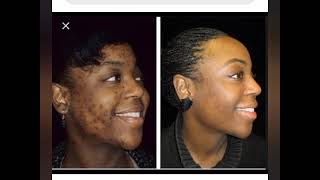 Umutaka Tv Bwiza Bwabakobwauburyohe Abakobwa Bateye Nezaabakobwa Basa Gutya