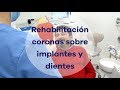 Rehabilitación coronas sobre dientes e implantes-Clinica Dental ClearDent