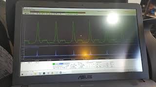 видео: Осваиваем диагностику двигателя на примере ЗМЗ 409. Тряска на холостом ходу картинка: Осваиваем диагностику двигателя на примере ЗМЗ 409. Тряска на холостом ходу