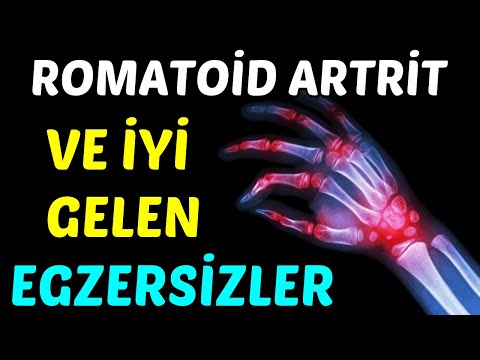 Video: Romatoid Artriti Teşhis Etmenin 5 Yolu