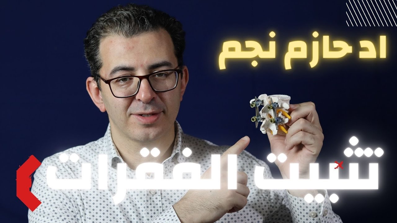 تثبيت الفقرات