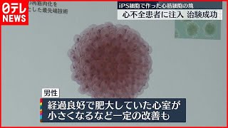 【世界初の治験に成功】iPS細胞から作った心筋細胞の塊を注入…　慶応大の福田教授らが発表