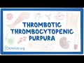 Thrombotic thrombocytopenic purpura (NORD)