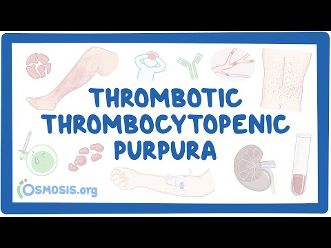 Video: Vem påverkar trombotisk trombocytopenisk purpura?