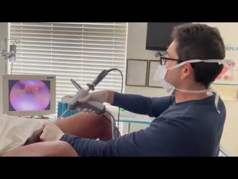 Full Rezum Procedure