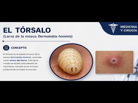 #miasis #cutanea #larvas #tórsalo #de #moscas #parasito