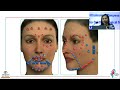 AIOS2025 GP243 Current Concept Face It A Young Ophthalmologist S Guide To Facial Aesthetics AIOS2025 GP243 Current Concept Face It A Young Ophthalmologist S Guide To Facial Aesthetics