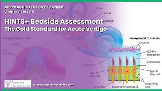 2/5 HINTS+ Bedside Assessment — The Gold Standard for Acute Vertigo | Approach to the Dizzy Patient