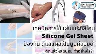 เทคนิคใช้แผ่นแปะซิลิโคน Silicone Gel Sheet รักษาแผลเป็นนูนคีลอยด์ ติดแล้วหลุดบ่อย ทำอย่างไร? หมอรุจ