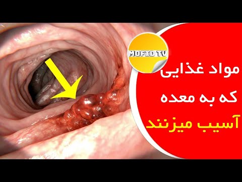 مواد غذایی که به معده آسیب میزنند و باعث مشکلات معده میشوند