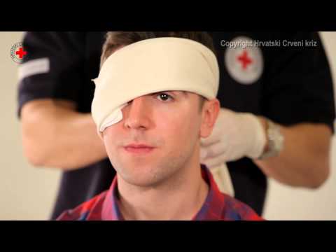 Video: Zaprta Prst: Prva Pomoč, Kirurgija In Okrevanje