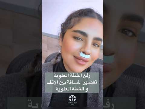 عملية رفع الشفة  الكويت فيلر بوت السعودية الرياض تجميل  