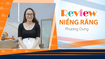 [Review niềng răng]: #185 Kết quả niềng răng của Phương Dung