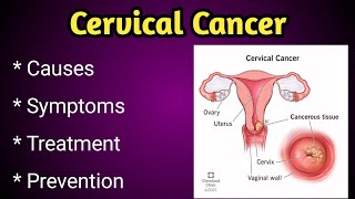 Cervical Cancer Causes, Symptoms and Treatment.
