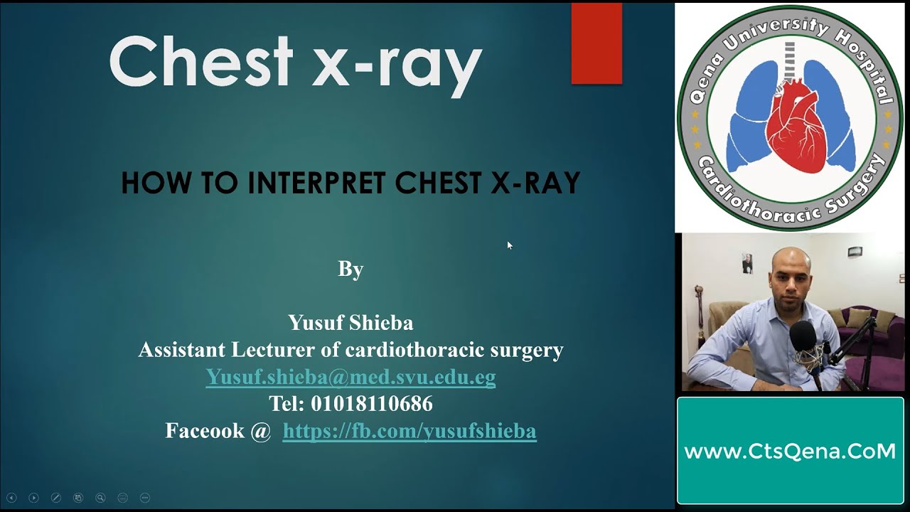 Chest XRay Quality How to Read Chest XRay 😀 YouTube
