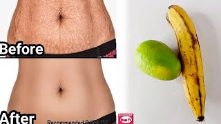 BANANA & LEMON TO REMOVE ALL YOUR STRETCH MARKS / World's best Remedy for Stretch mark Removing