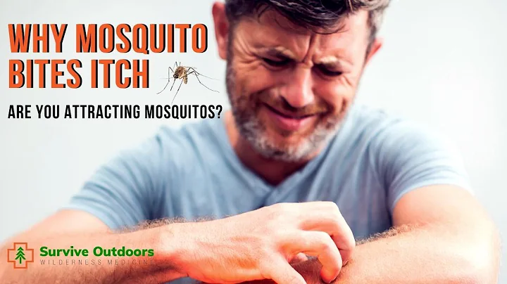 Why do Mosquito Bites Itch? - What blood type do mosquitos like?