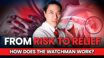 Watchman in Atrial Fibrillation Explained