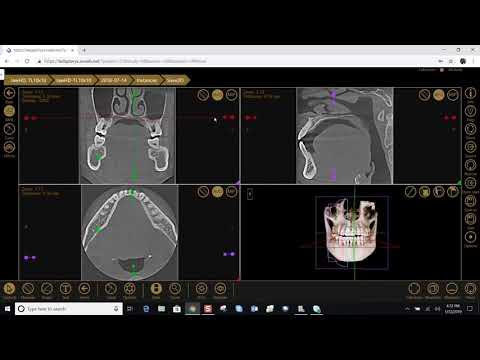 Training: Apteryx XVWeb 3D: Navigating CBCT Scans