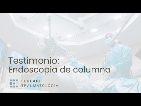 Testimonio de Endoscopia avanzada de columna en Madrid