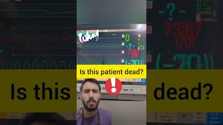 CABG monitor screen | Is this patient dead ? ##anesthesiaresident #cabg