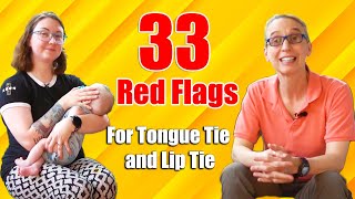 33 Red Flag for Tongue Tie or Lip Tie: Physical Therapy For a Child with Torticollis #27