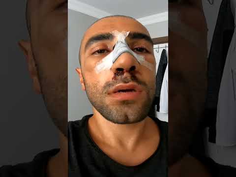 Video: Zicam burun tamponlarında sink varmı?