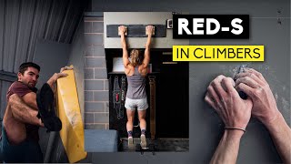 Dieting and Weight Management: RED-S In Climbing
