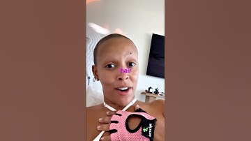 Why Doja Cat went BALD 😳